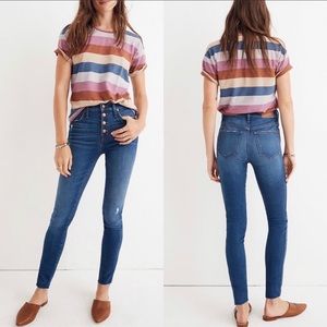 Madewell Button Fly 10” High-Rise Skinny